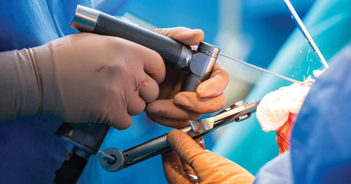 Understanding the Advancements in Orthopaedic Surgery