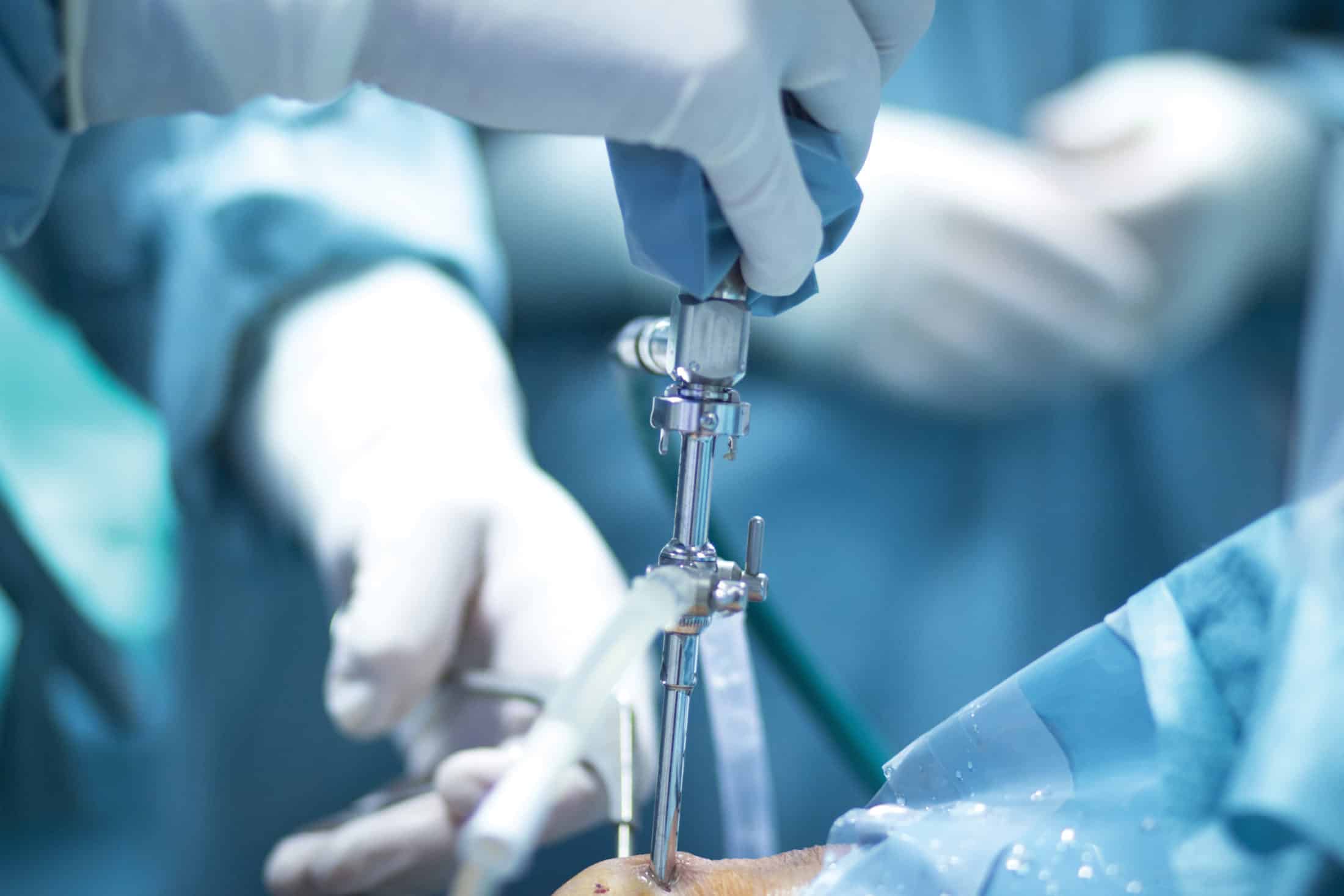 The Latest Advancements in Orthopaedic Surgery
