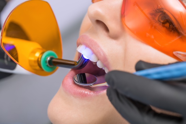 The Benefits of Dental Lasers