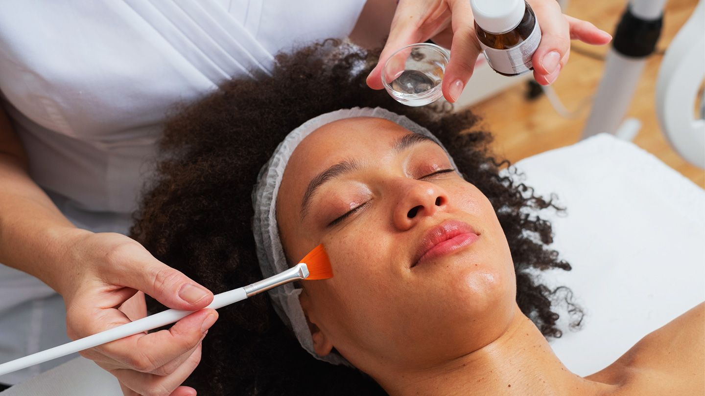 The Benefits and Risks of Chemical Peels: A Comprehensive Guide