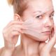 Chemical Peels : What They Are and How They Work
